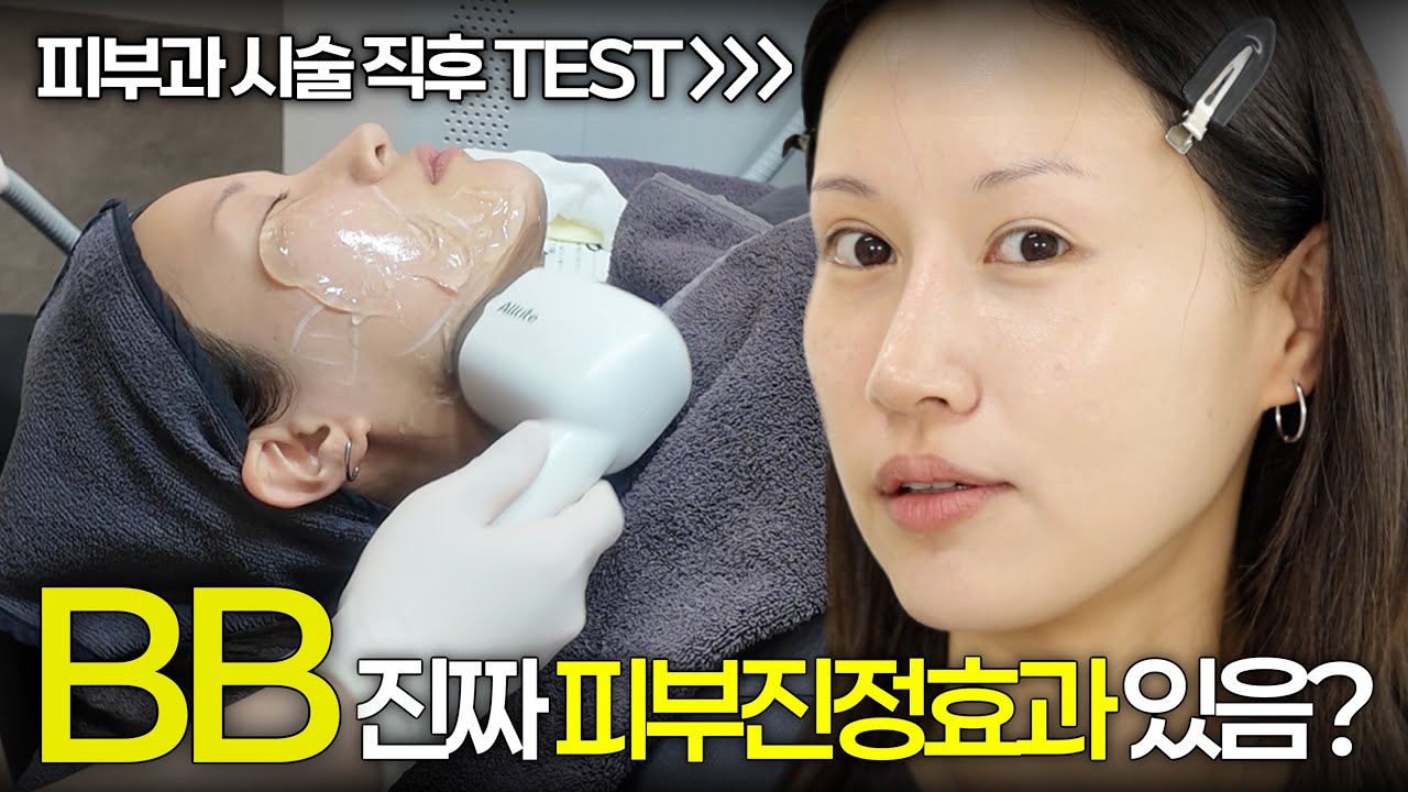 아니...진짜 궁금해서🤔 피부과 시술 직후, 비비크림 발라봤는데요‼️ BB환승했습니다!