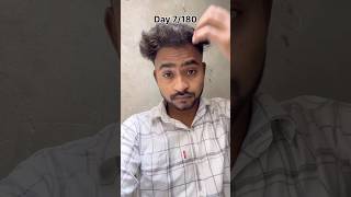Minoxidil Journey Day 7 💪 Rukna Mana Hai!” #minoxidil #vlog #viral #haircare #dailyvlog