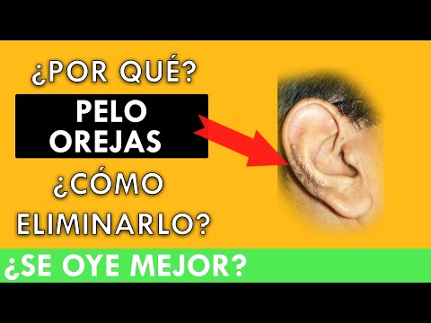 Video: 3 formas de eliminar el vello de las orejas
