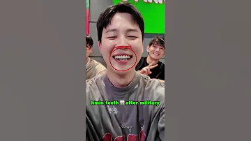Jimin Fixed His Cooked Teeth Bts Cutelife 