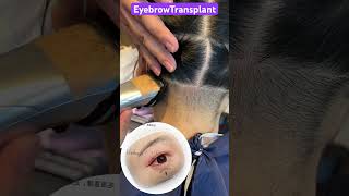 EyebrowTransplant ?? eyebrowtransplant eyelashextensions permanenteyebrows microbladingbrows