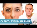 Как сделать рубец на лице незаметным?