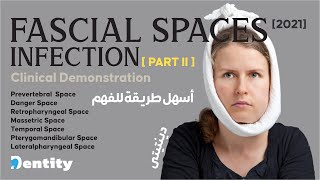 شرح مبسط | Fascial Spaces Infection [ PART 2/2 ]