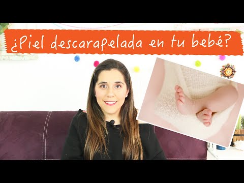 Video: Qué Hacer Si Un Recién Nacido Tiene Piel Escamosa