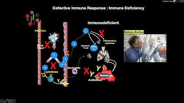 04 T regulatory cell  are they defective in autoimmune disease Dr  Srinivas  V  Kaveri, MVS, Ph  D