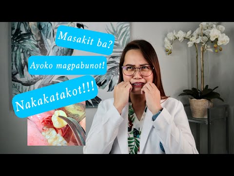 Video: Kailangan ko bang magbunot ng mga damo bago magbungkal?