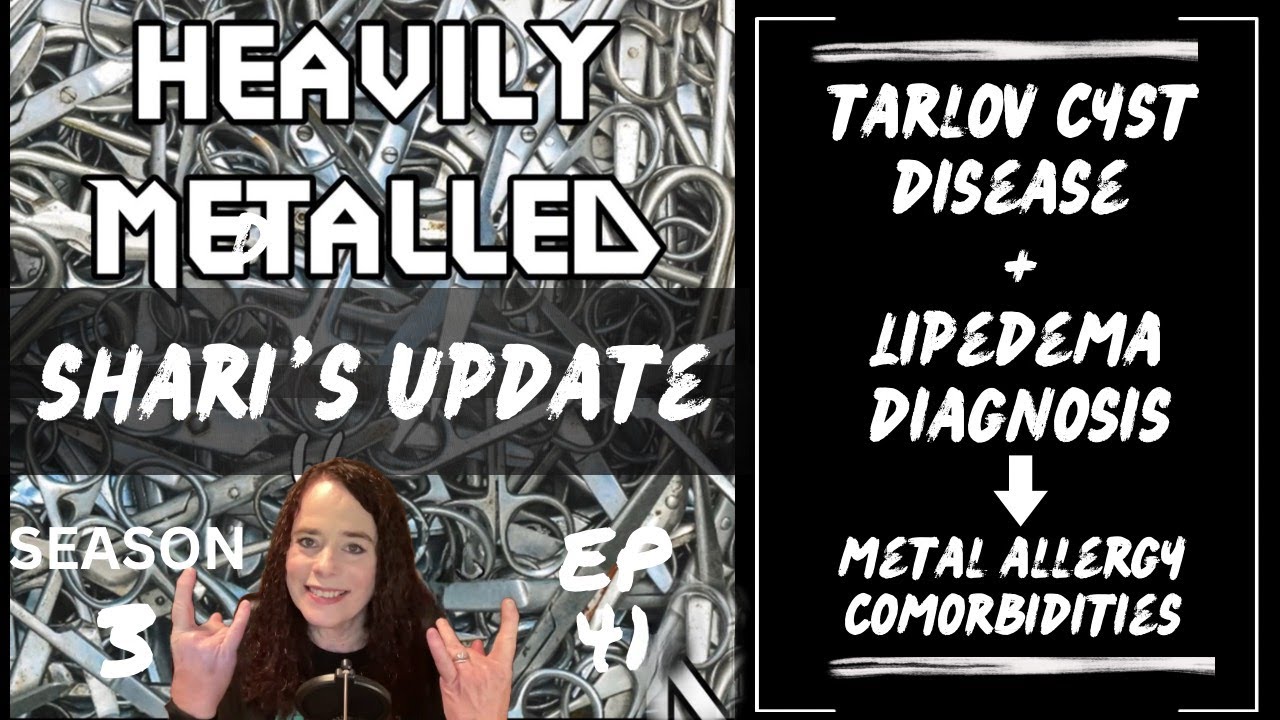 EP41- Shari’s Update-Comorbidities of Metal Allergies-Tarlov Cysts, Lipedema & Connective Tissues