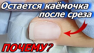 ОСТАЁТСЯ КАЁМОЧКА ПОСЛЕ СРЕЗА?