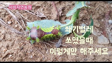 쐐기 벌레에 쏘였을때