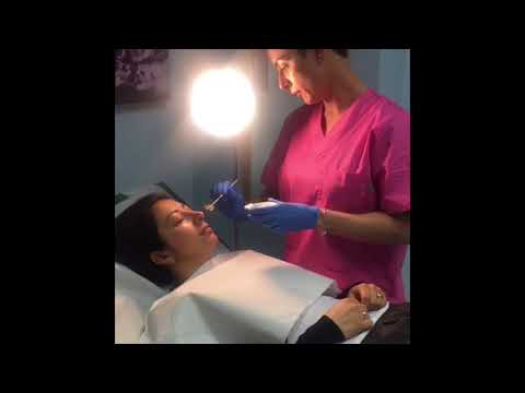 Video: Peeling viso chimico multiacido