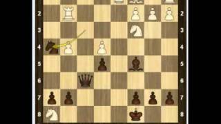 Уроки шахмат - Контратака Тракслера 4