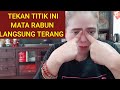 Cara Mengatasi Mata Buram Rabun Cara Mengatasi Mata Buram Rabun