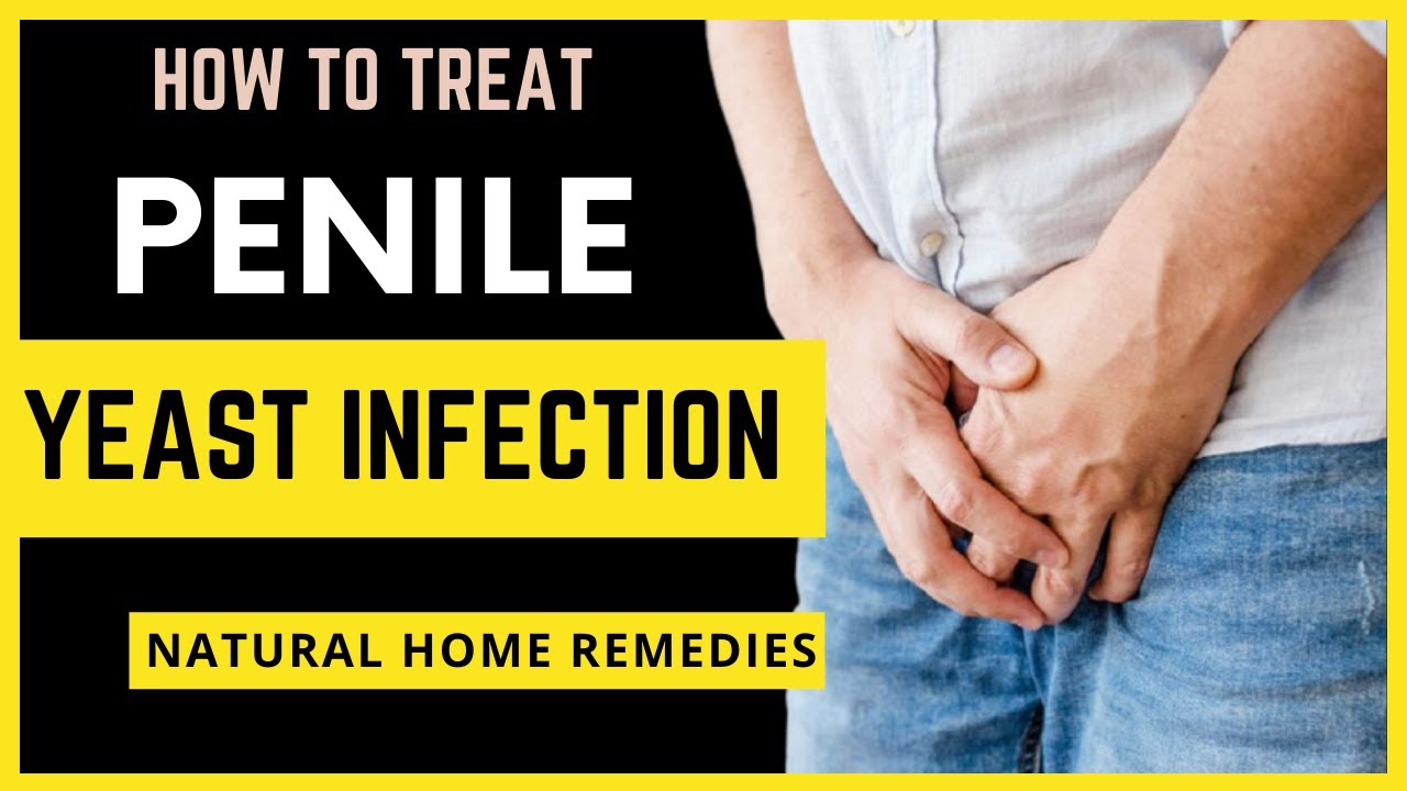 Penile Yeast Infection - How to Treat Infection (Natural Home Remedies)