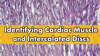 Fibrocartilage vs Cardiac Muscle (Histology FAQ) by Anatomy Hero 3,950 views 7 months ago 1 minute, 46 seconds