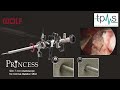 Resectoscope set princess  richard wolf tpms