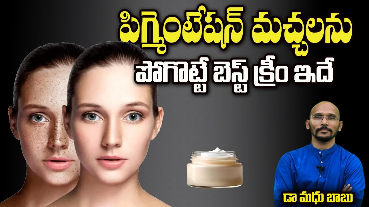 పిగ్మెంటేషన్ మచ్చలను పోగొట్టే బెస్ట్ క్రీం ఇదే | Pigmentation Cream | Dr.Madhu Babu Health Trends