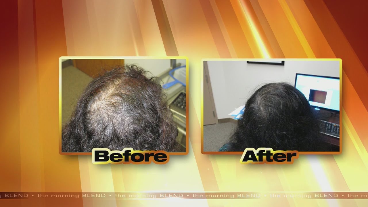 Regrow Your Own Natural Hair 6/8/16