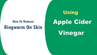 Amazing Tips To Use Apple Cider Vinegar For Ringworm On Skin - How To Remove Ringworm On Skin