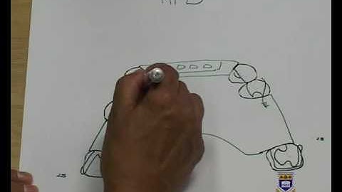 Designing an Upper Metal Partial Denture Kennedy Class III