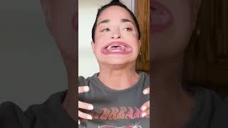 اغرب   ارقام قياسيه في موسوعة جينيس عن جسم الانسان سمعها