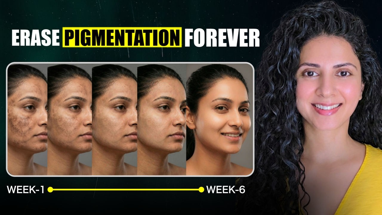 Video: 7 Natural Remedies for Pigmentation and Melasma, by Daisy