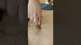 2 appendicitis painful point 2nd take
