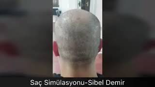Saçlardaki büyük değişim 👉  Saç Simülasyonu