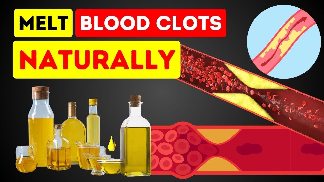 LIVE - 10 Best Foods for High Blood Pressure | Foods To Reduce Blood ...