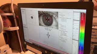 Oculus Pentacam How To obtain Scans