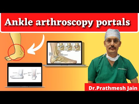 Ankle Arthroscopy Portals