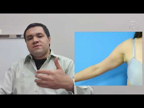 فيديو: هل تمتد أنسجة الثدي إلى الإبط؟