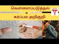 White discharge during early pregnancy in tamilvellai paduthaldoctorpregnancytamil