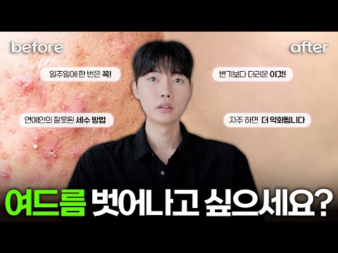 여드름, 트러블 고민이면 이 영상 무조건 보셔야 합니다