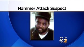 CBS2 Exclusive: Man Attacked By Hammer Wielding Assailant