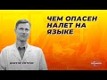 Чем опасен налет на языке.