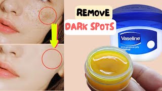 Apply Vaseline & Turmeric on Face to Remove DARK SPOTS in 3 Days - Best Collagen Cream for Wrinkles