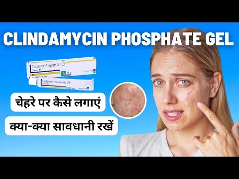 clindamycin phosphate gel usp | pimples removal | clindac