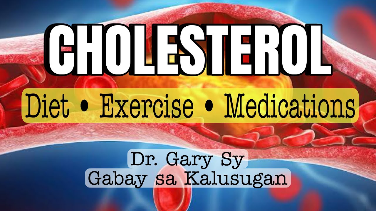 MATAAS BA ANG INYONG CHOLESTEROL? Ano ang pwede at bawal kainin? - Dr. Gary Sy
