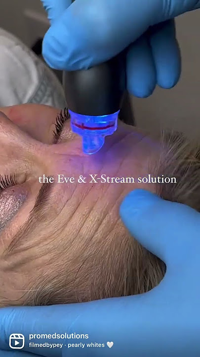 ProMed Solutions: 2023 ESSENTIAL Aesthetic Equipment