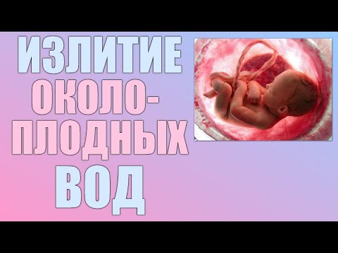 Преждевременное отхождение околоплодных вод. В чем опасность отхождения вод