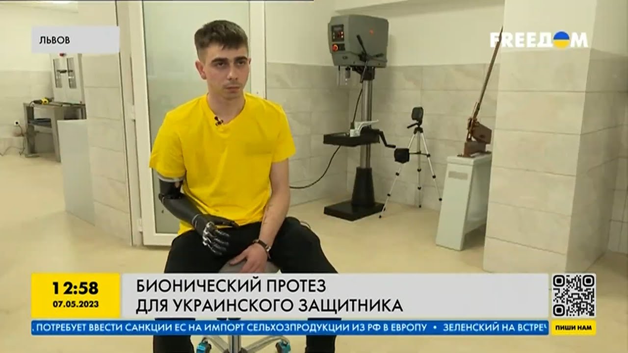 Для украинского защитника создали уникальный бионический протез