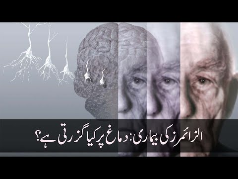 What Happens To The Brain During Alzheimer&rsquo;s? (Urdu Dubbed)