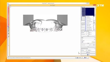 OnyxCeph³™ Module Kylix 3D