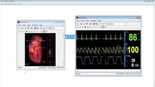 ECG Signal Processing Matlab Code Projects