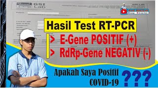 VIRAL WANITA NGAMUK BELUM TEST TAPI HASIL PCR NYA SUDAH KELUAR DAN POSITIF