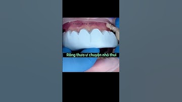 trám răng thưa thẩm mỹ #shortvideo #dental #dentist #răngsứthẩmmỹ  #veneers #composite #short