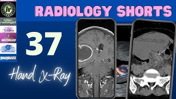 WRIST RADIOGRAPH || RADIOLOGYSHORTS 37 || NOBAKBAK VIDEOS || #indianradiologist