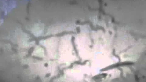 A good view of a variety of spirochetes found in a horribly diseased mouth.