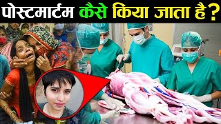 देखिए Post mortem के रूम में क्या होता है | REALITY Of post mortem