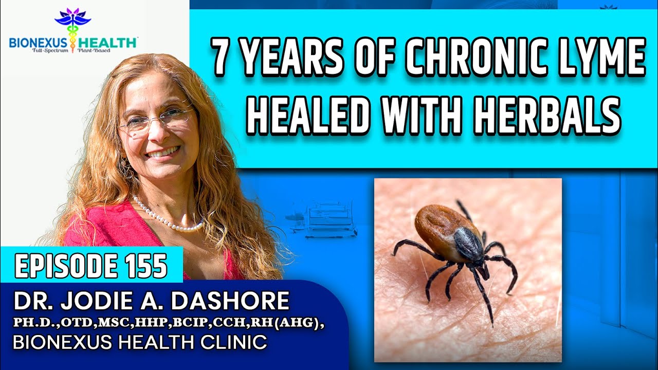 Episode 155: 7 Years Fighting Chronic Lyme | How I Finally Recovered with Herbal Medicine